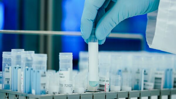 Ein Mitarbeiter hält in einem Coronatest-Labor PCR-Teströhrchen in den Händen., © Uwe Anspach/dpa
